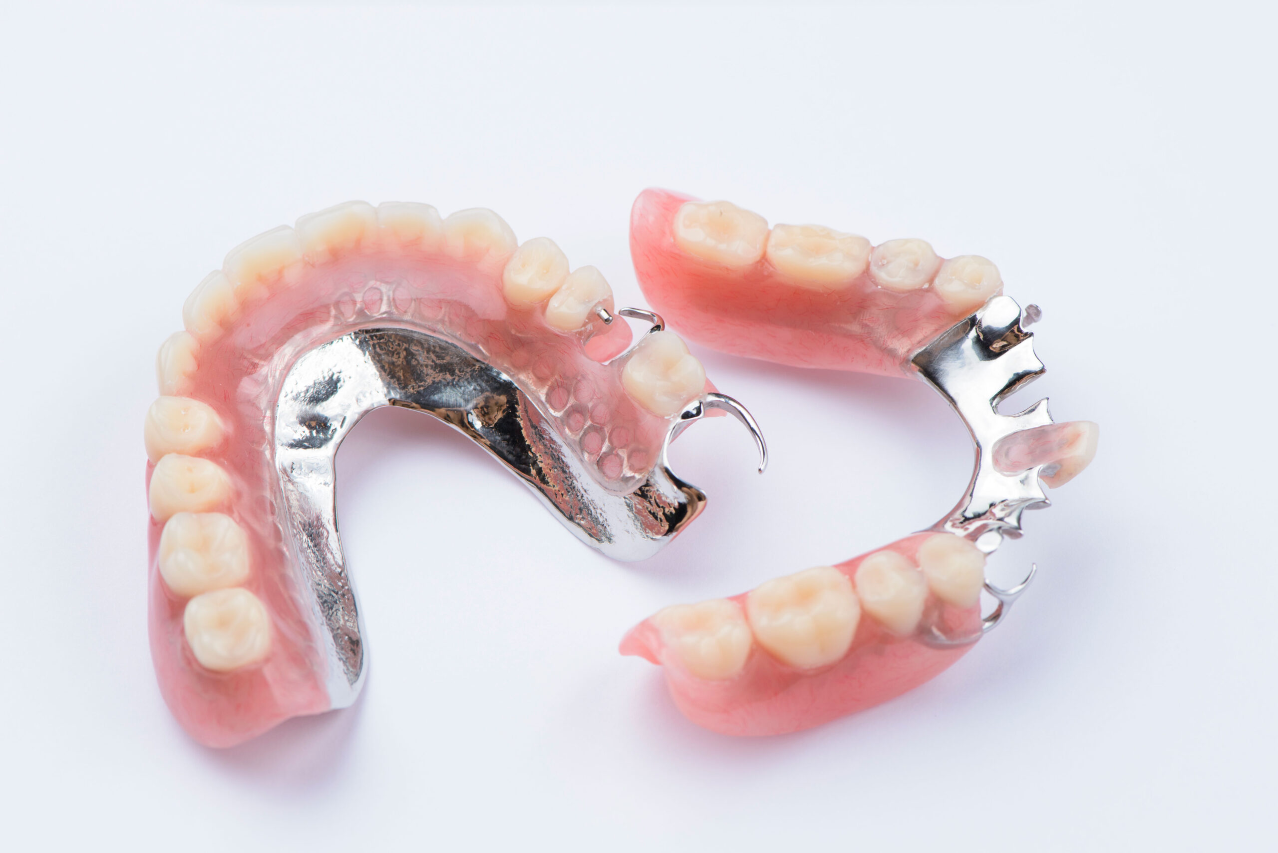 Removable metal partial denture on white background